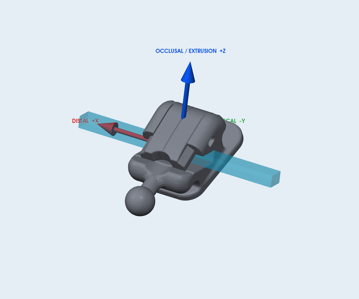 Mắc cài 3B LinPass SL – răng 11