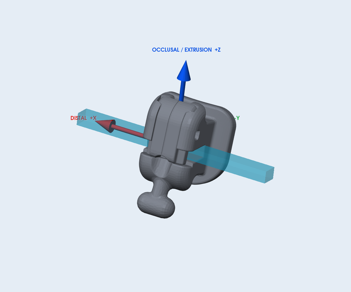 Mắc cài 3B LinPass SL – răng 14