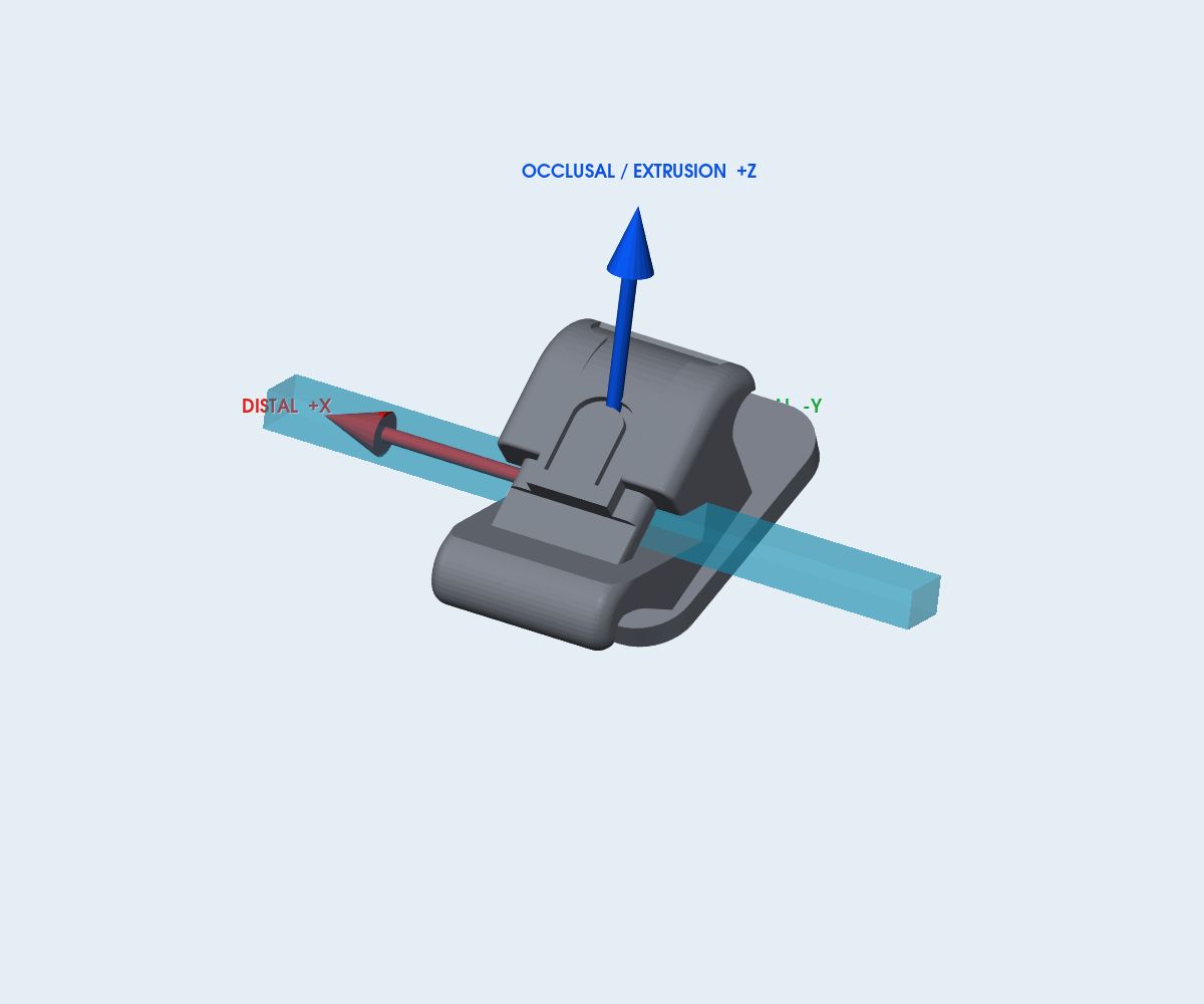 Mắc cài DTC In-Tendo JK-SL – răng 11