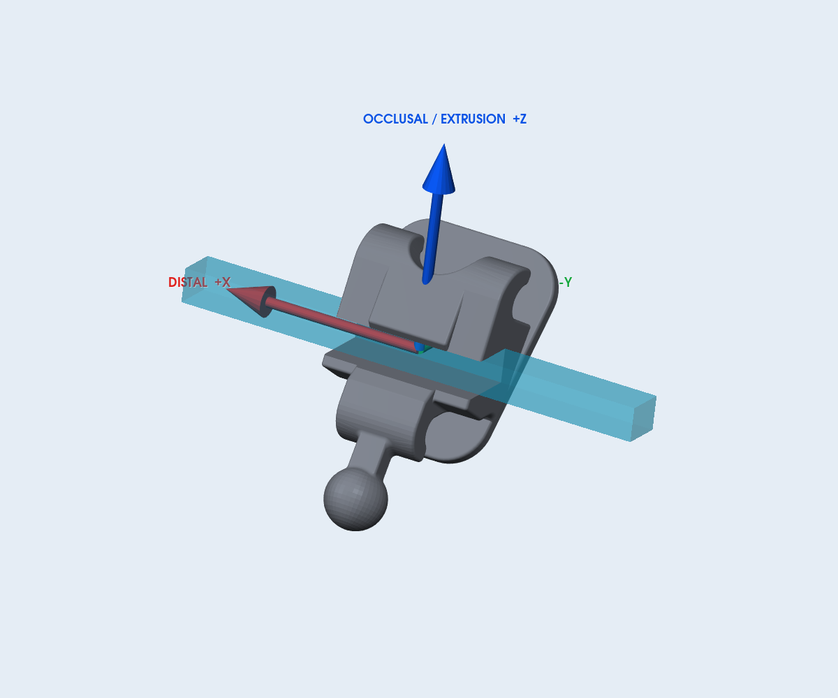 Mắc cài Protect Lingual Horizontal – răng 11