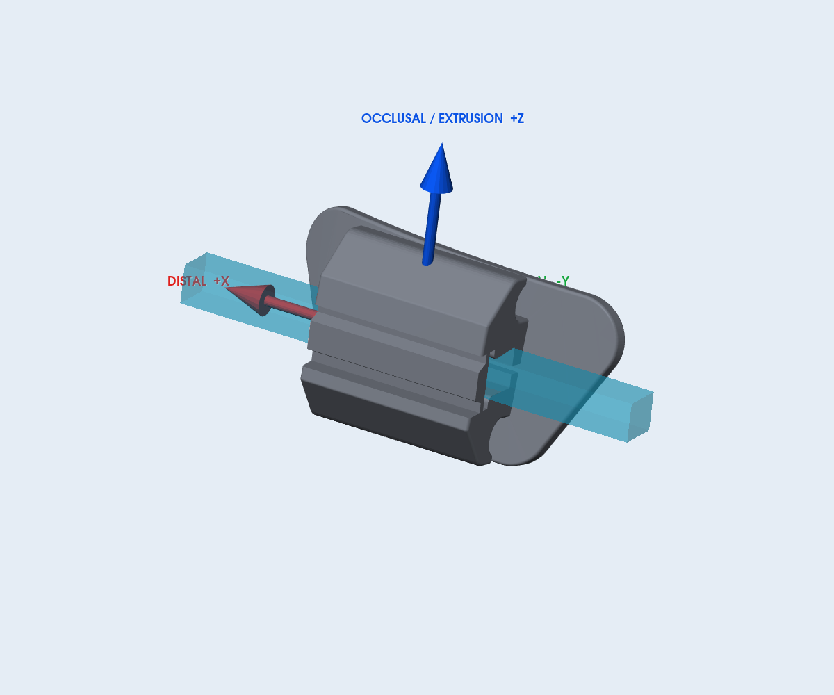 Mắc cài Protect Lingual Horizontal – răng 16