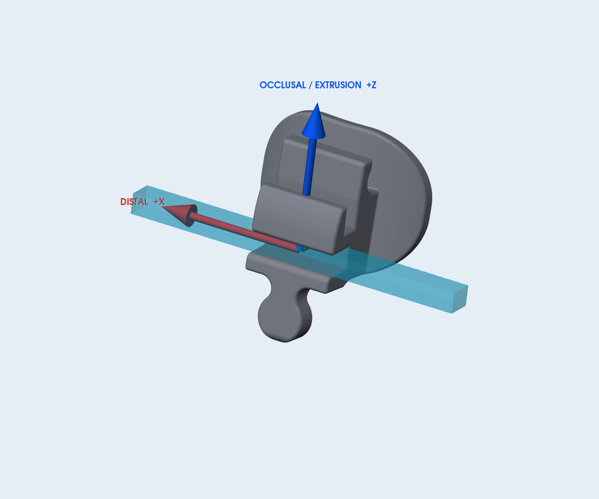 Mắc cài Protect Lingual Twin-Slot – răng 14
